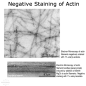 Preview: Actin-Toolkit Electron Microscopy (bovine alpha-cardiac actin)