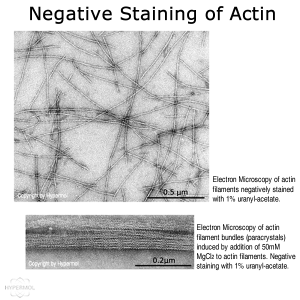 Actin-Toolkit Electron Microscopy (bovine alpha-cardiac actin)