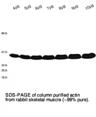 Actin (rabbit skeletal muscle alpha actin) 4x250µg