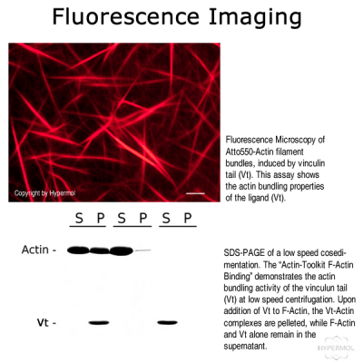 Actin-Trialkit Fluorescence Microscopy ATTO565 (skeletal muscle actin)