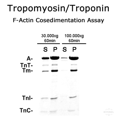 Tropomyosin/Troponin (rabbit skeletal muscle) - 2x100µg